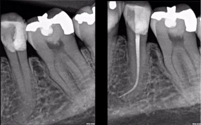 CASE STUDY:  Hugo Bastos Case 10