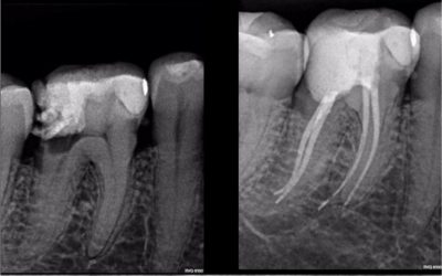 CASE STUDY:  Hugo Bastos Case 8