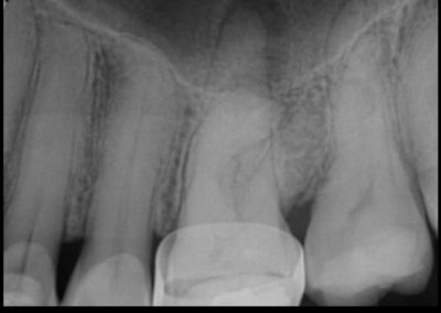 Case-Study-Images-Batelreri-1