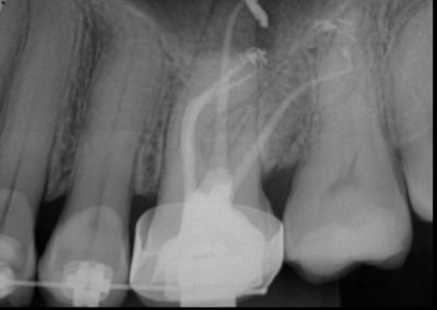 Case-Study-Images-Batelreri-2