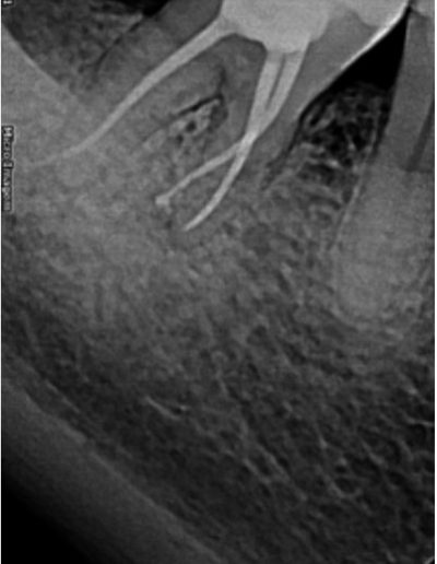 Case-Study-Images-Carlos-Henrique-1-1