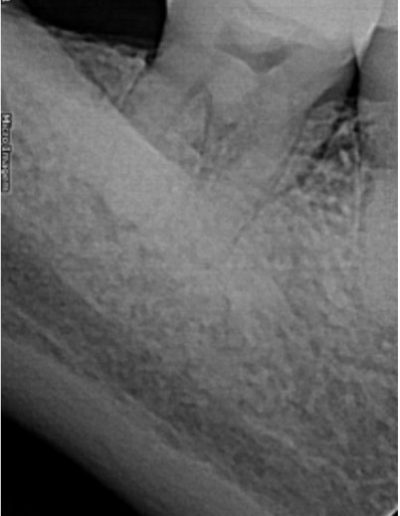 Case-Study-Images-Carlos-Henrique-1-1_3