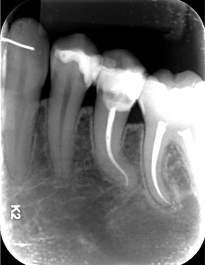 Case-Study-Images-Guilherme-1-2_2-e1523305094402